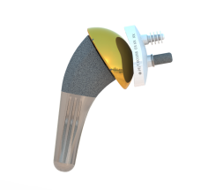 ISA Inlay prothèse totale d'épaule inversée