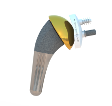 Aide à la pose d’une prothèse ISA: planification et guide chirurgical