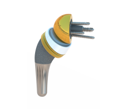 Aide à la pose d’une prothèse ISA: planification et guide chirurgical